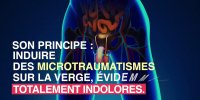 Des ondes de choc pour traiter les troubles érectiles