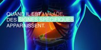 Foie malade : 3 symptômes d'alerte