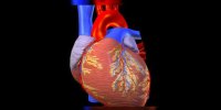 L'infarctus du myocarde expliqué en vidéo