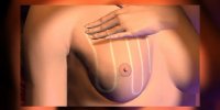 Auto-examen des seins expliqué en vidéo