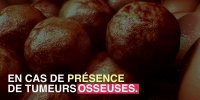 Un risque de cancer secondaire à cause d'un médicament