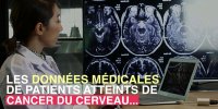 Pourquoi la taille de votre cerveau joue sur votre risque de cancer