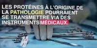 Maladie d'Alzheimer : une transmission via des instruments médicaux ?