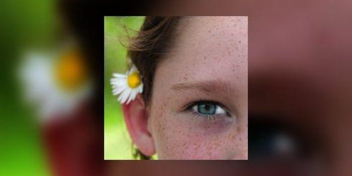 Le Chalazion De L Enfant Benin Mais Recidivant Le Chalazion De L Enfant Benin Mais Recidivant