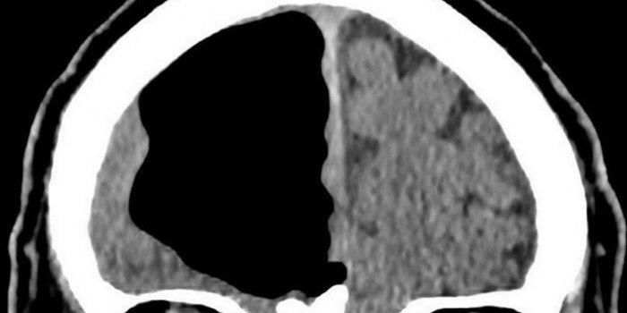 BMJ Case Reports, Finlay Brown et Djamil Vahidassr (2018)