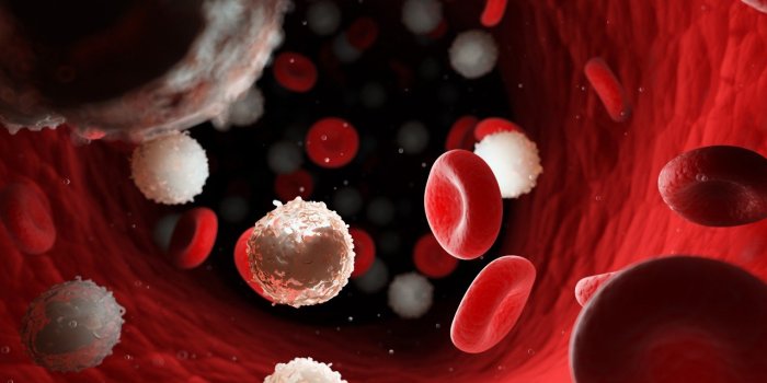 Cancer du sang : les symptomes a reperer
