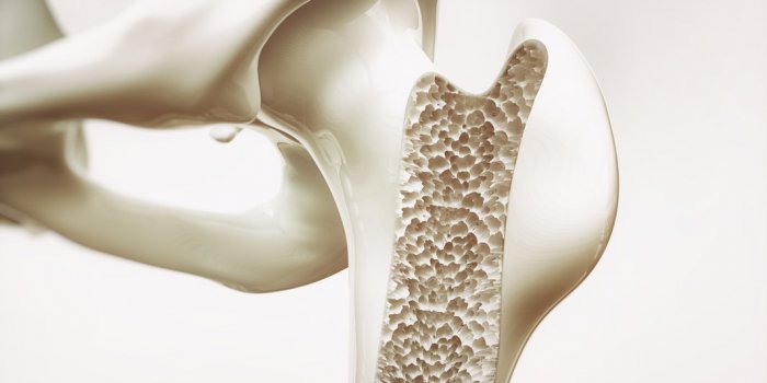 Osteoporose : 10 aliments qui protegent