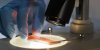 Cancer du sang : que sont les cancers hématologiques ?