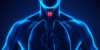 Nodule thyroïdien : un signe de cancer ?