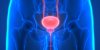 Prostatite et cancer de la prostate : existe-t-il un lien ?