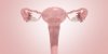 Cancer de l'utérus : le cancer de l'endomètre