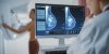 Cancer du sein : la mammographie est-elle efficace après 75 ans ?