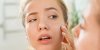 Démangeaisons : une peau sèche peut être un signe d'allergie