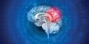 Tumeur au cerveau : quels examens faire ?