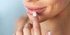 Infection des lèvres : comment soigner la perlèche