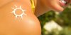 Au soleil, attention à la photosensibilisation sous médicaments contre l’acné