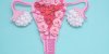 SOPK : le régime cétogène permettrait de favoriser la fertilité des femmes atteintes