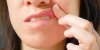 Pourquoi certains aliments donnent des aphtes ? 