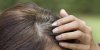 5 conseils pour éviter les cheveux gris