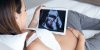Coronavirus : la transmission mère-bébé pendant la grossesse serait bien possible