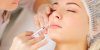Botox : qu'en attendre et à partir de quel âge ?