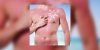Le « sunburn art » : la mode à ne pas suivre