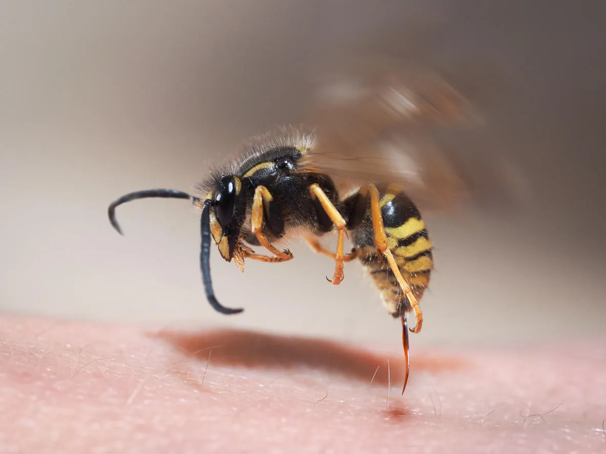 wasp sting pulls out of human skin macro wasp sting pulls out of human skin macro