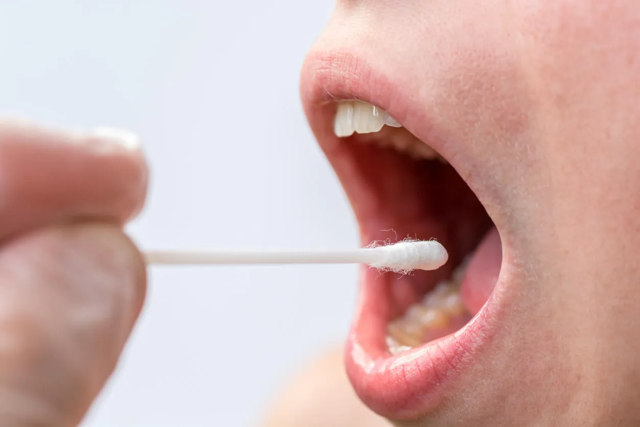 saliva test on the mouth with cotton swabs as a test for various diseases saliva test on the mouth with cotton swabs as a test for various diseases