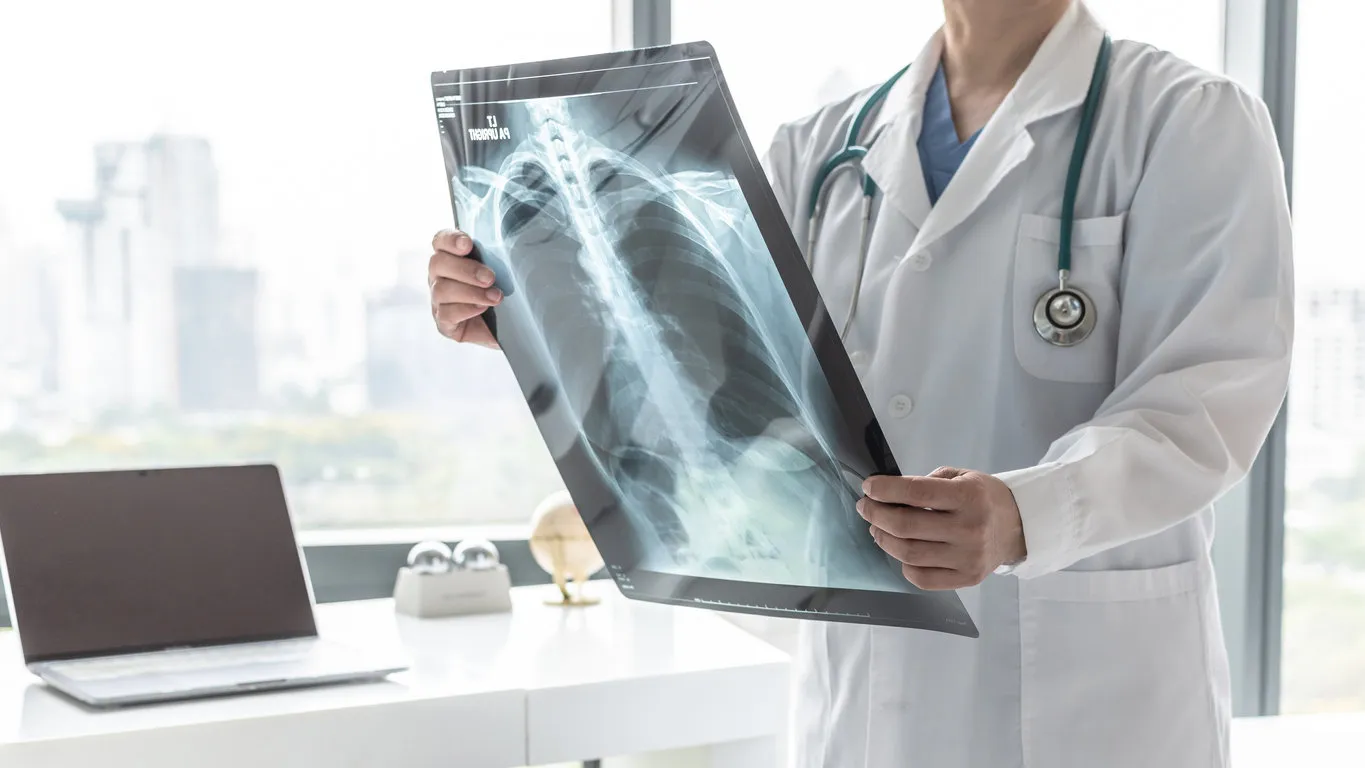 doctor with radiological chest x-ray film for medical diagnosis on patientâs health on asthma, lung disease and bone cancer illness, healthcare hospital service concept doctor with radiological chest x-ray film for medical diagnosis on patientâs health on asthma, lung disease and bone cancer illness, healthcare hospital service concept
