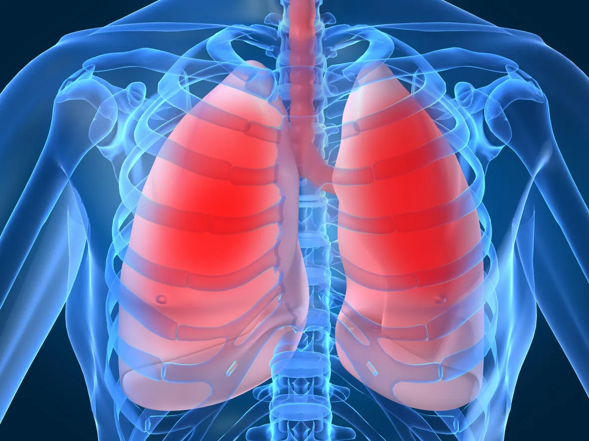 infection pulmonaire