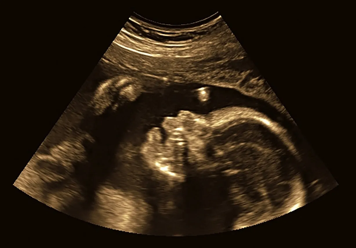ultrasound of baby in pregnant woman in dark background ultrasound of baby in pregnant woman in dark background