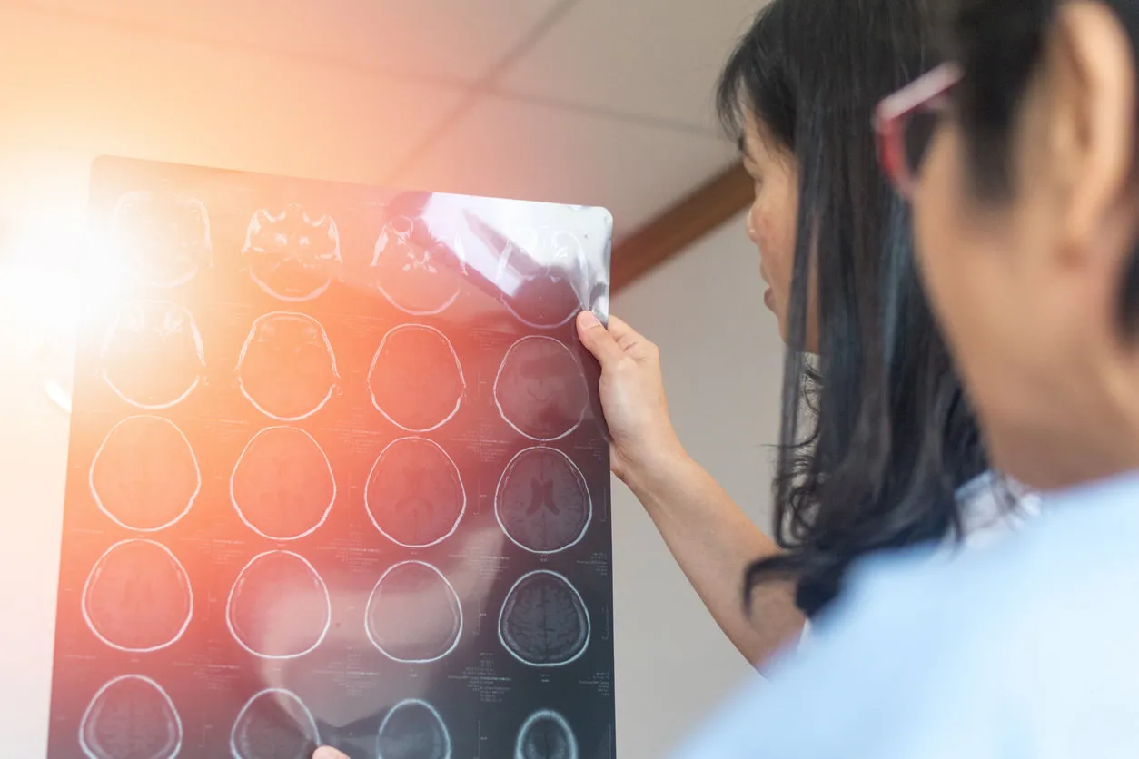neurologist doctor or radiologist show mri x-ray film scan of brain to consult with stroke patience in hospital neurologist doctor or radiologist show mri x-ray film scan of brain to consult with stroke patience in hospital