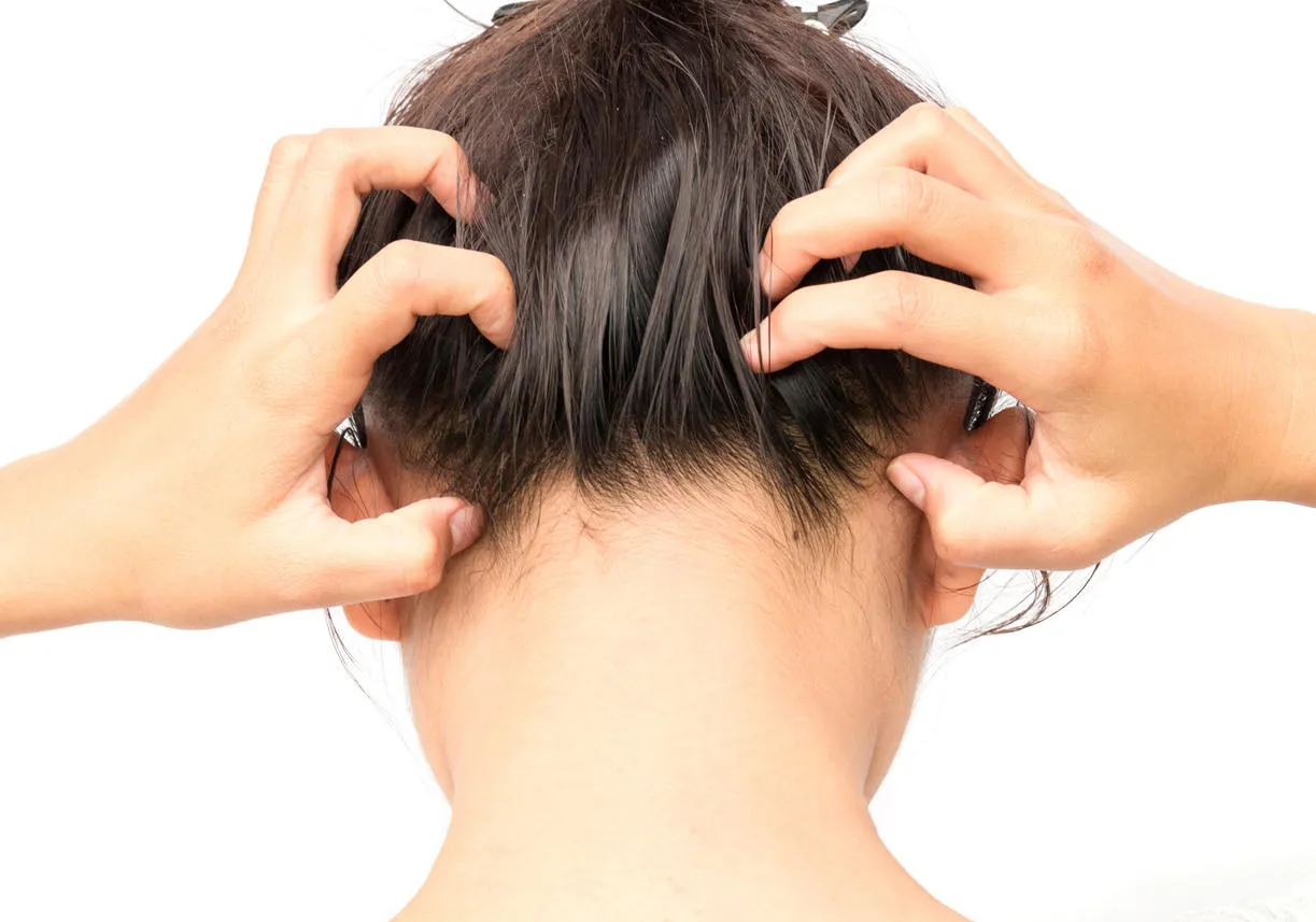 closeup woman hand itchy scalp, hair care concept closeup woman hand itchy scalp, hair care concept