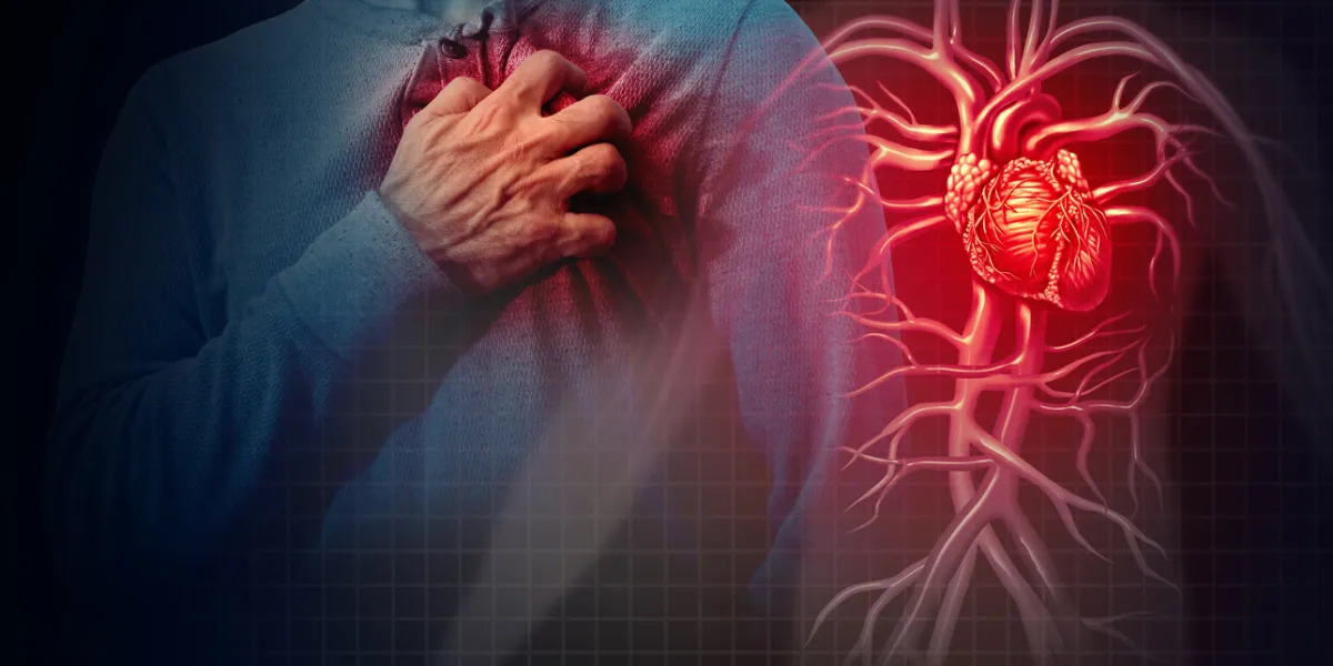 heart attack concept and human cardiovascular pain as an anatomy medical disease concept with a person suffering from a cardiac illness as a painful coronary event with 3d illustration style elements