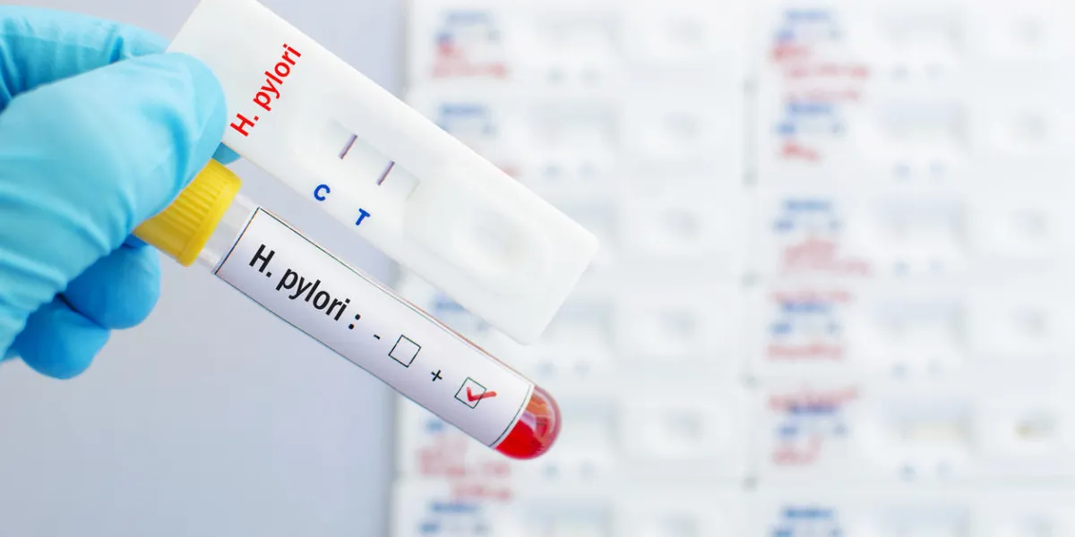 cassette de test rapide pour les tests h pylori dans le sang cassette de test rapide pour les tests h pylori dans le sang