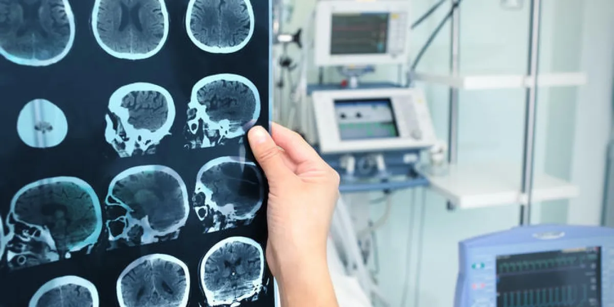 interprétation de la tomographie du cerveau dans l'icu interprétation de la tomographie du cerveau dans l'icu