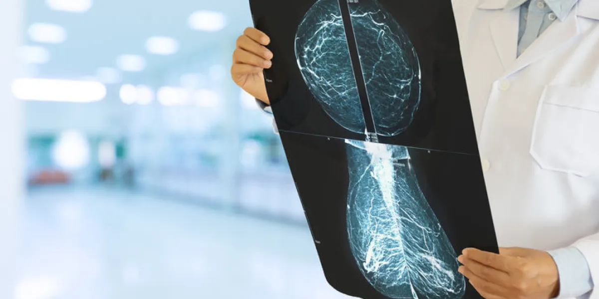 unrecognizable female gynecologist looking at a mammogram checking for breast cancer at the hospital unrecognizable female gynecologist looking at a mammogram checking for breast cancer at the hospital