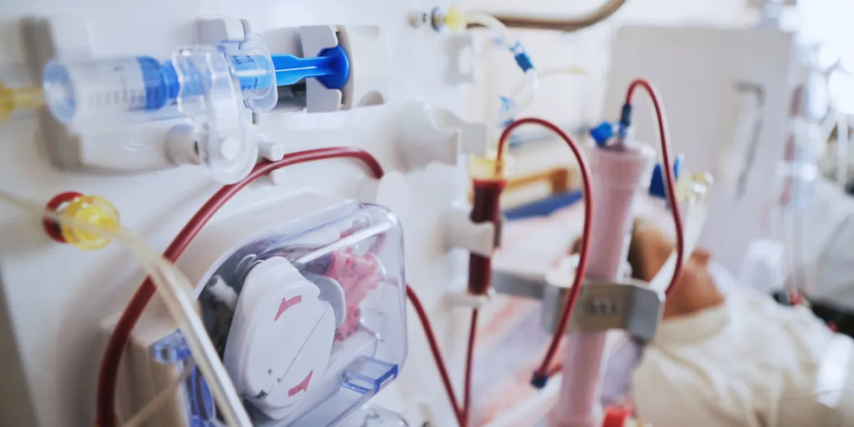 bloodline tubes with hemodialysis machine in the background health care, blood purification, kidney failure, transplantation bloodline tubes with hemodialysis machine in the background health care, blood purification, kidney failure, transplantation