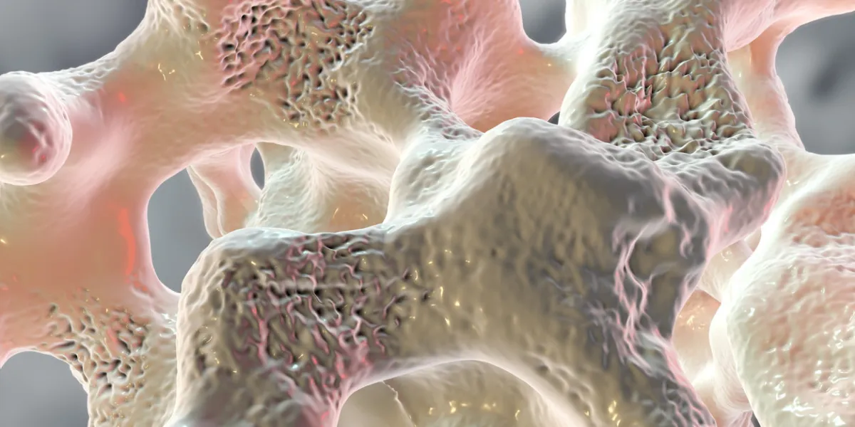 spongy bone tissue affected by osteoporosis, 3d illustration