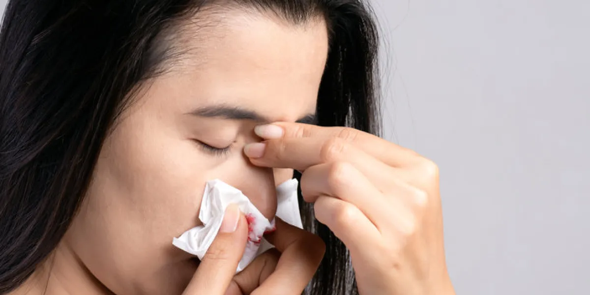 nosebleed , a young woman suffering from nose bleeding and using tissue paper for stop bleeding healthcare and medical concept nosebleed , a young woman suffering from nose bleeding and using tissue paper for stop bleeding healthcare and medical concept