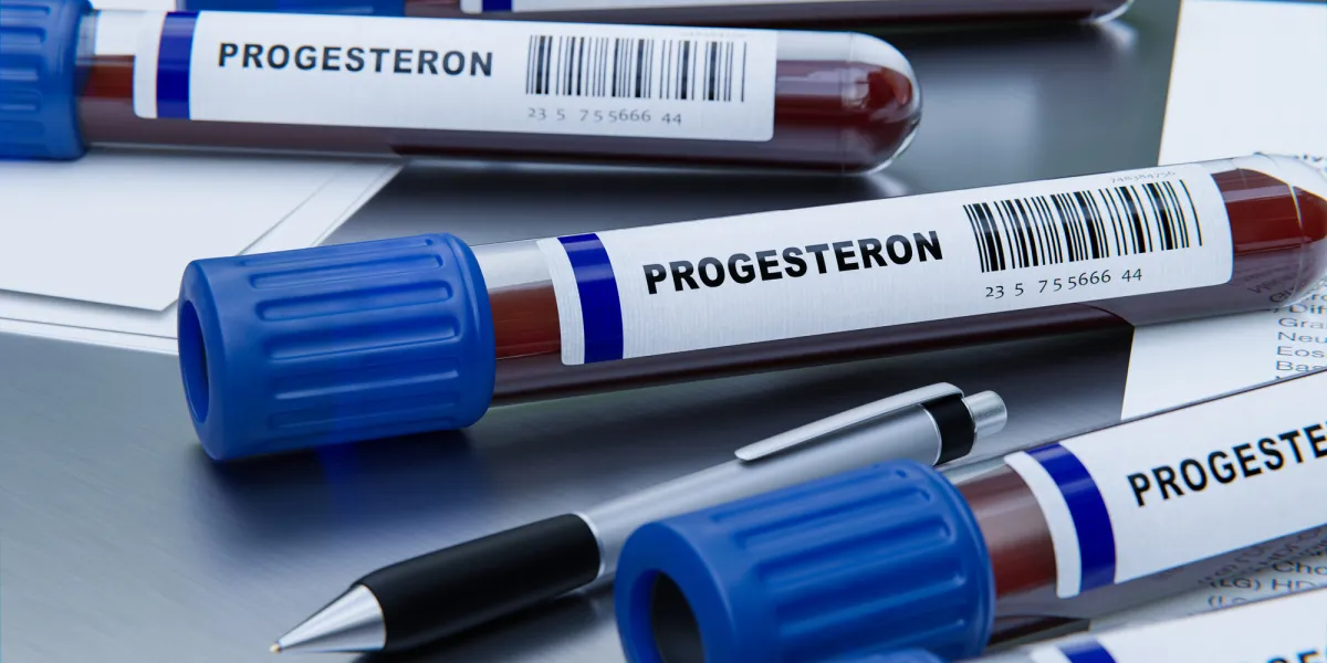 progesteron hormon messung mit bluttest im labor