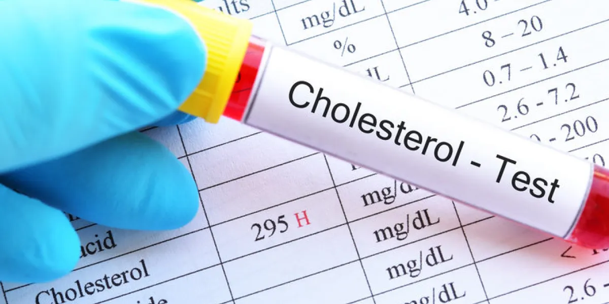 blood sample tube with abnormal high cholesterol test result blood sample tube with abnormal high cholesterol test result
