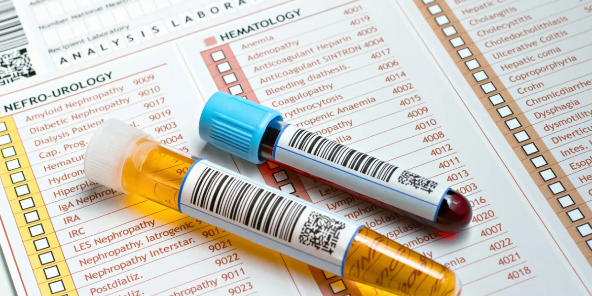 two tubes labeled with bar codes, each urine sample and one with blood on a medical report for a routine analysis two tubes labeled with bar codes, each urine sample and one with blood on a medical report for a routine analysis