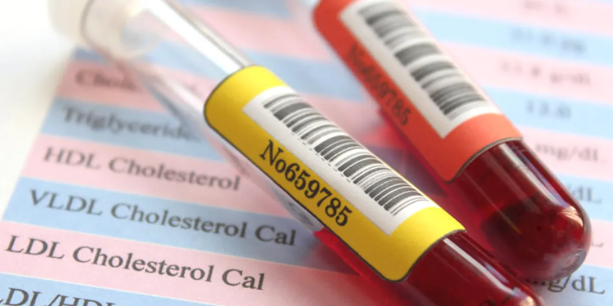sample of blood collectionsample of blood collection sample of blood collectionsample of blood collection