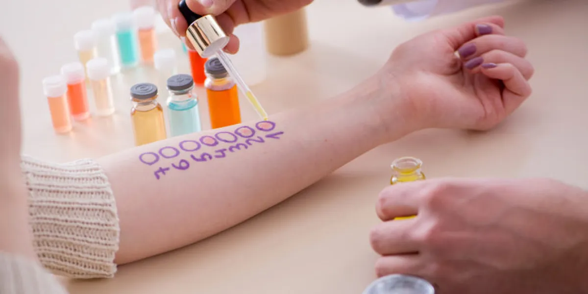 doctor testing allergy reaction of patient in hospital doctor testing allergy reaction of patient in hospital