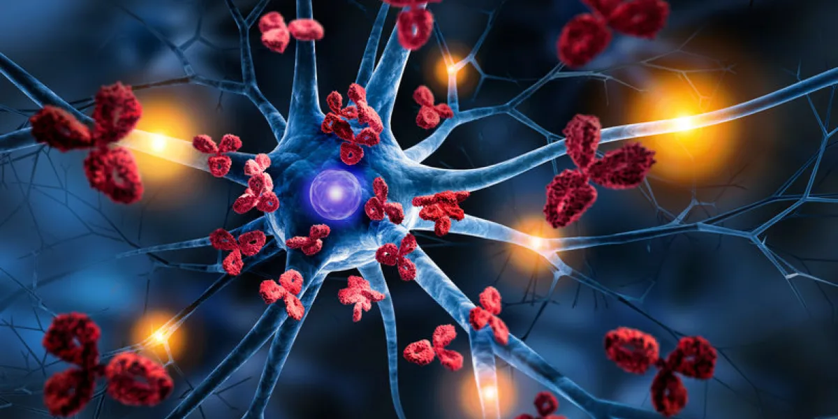 nerve cells with antibodies - autoimmune disease nerve cells with antibodies - autoimmune disease