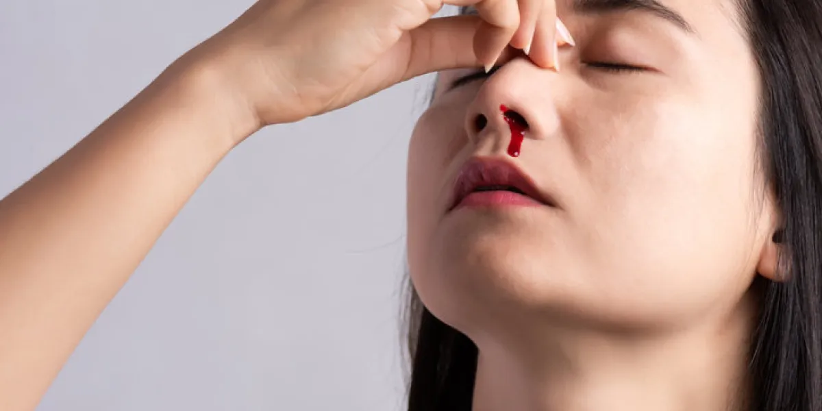 nosebleed , a young woman with a bloody nose healthcare and medical concept nosebleed , a young woman with a bloody nose healthcare and medical concept
