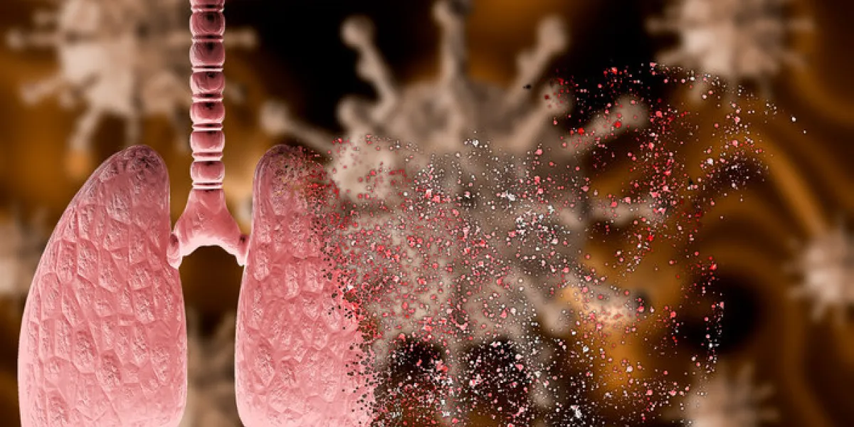 coronavirus attacking lung with severe pneumonia disintegrating it, leading to death 3d rendering coronavirus attacking lung with severe pneumonia disintegrating it, leading to death 3d rendering