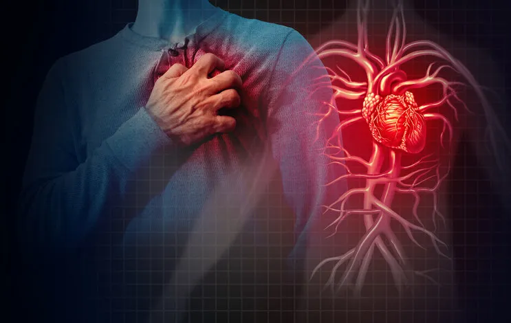 heart attack concept and human cardiovascular pain as an anatomy medical disease concept with a person suffering from a cardiac illness as a painful coronary event with 3d illustration style elements