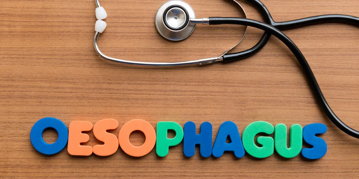 oesophagus colorful word on the wooden background oesophagus colorful word on the wooden background
